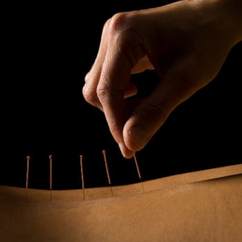 Acupuncture in Union, NJ